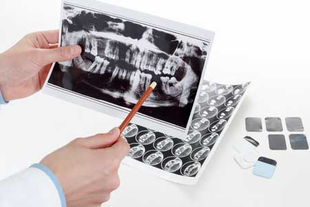 cirugía dental por ordenador en Madrid Implante dental Madrid Centro